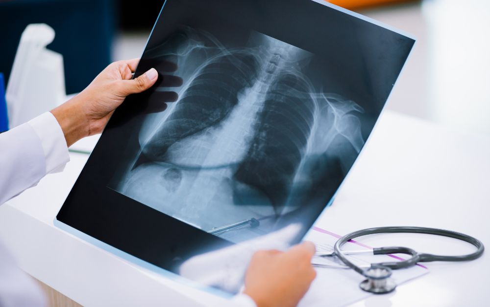 Phụ nữ trong kỳ kinh nguyệt vẫn có thể chụp X-quang phổi an toàn