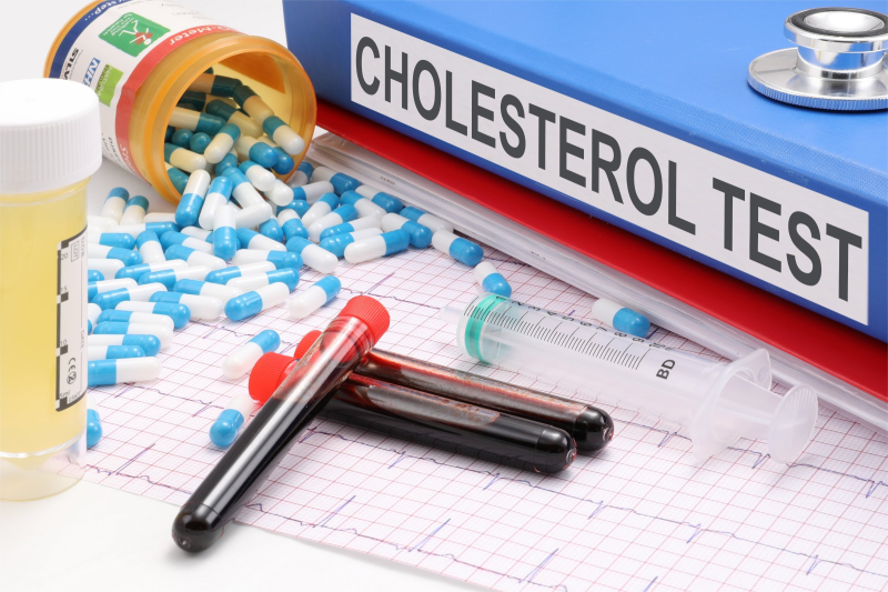 Xét nghiệm cholesterol cần nhịn ăn ít nhất 9 tiếng trước khi thực hiện