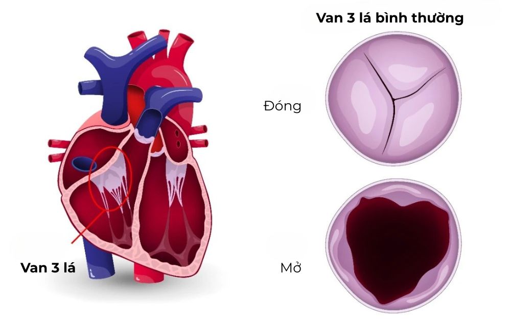Cấu trúc và hoạt động bình thường của van ba lá