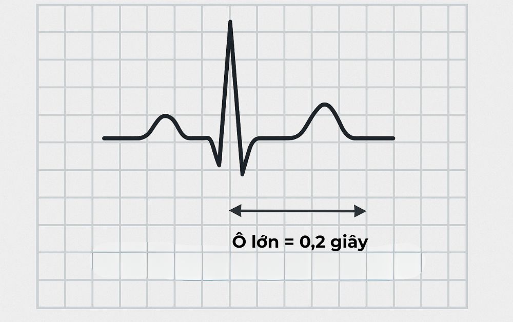 Mỗi ô lớn trên điện tâm đồ tương ứng 0,2 giây và là cơ sở để tính tần số tim chính xác